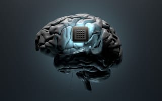 Brain Implants Will Arrive Sooner Than You Think. What Does That Mean?