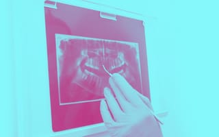 6 Top Dental Companies and Startups to Know