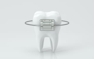 A single tooth is pictured wrapped in an orthodontic brace.