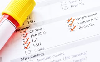 A blood test form shows various hormones with checkmarks, including cortisol and testosterone. A yellow-capped test tube lies on the form.
