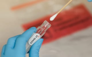 Sherlock Biosciences’ CRISPR-Enabled COVID-19 Test Gets FDA’s Emergency Use OK
