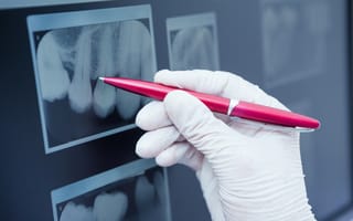 Overjet Raises $7.85M to Bring Computer Vision AI to Dentistry