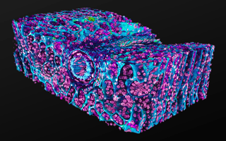 Lightspeed Microscopy Raises $4M to Help Pathologists See Cells in 3D