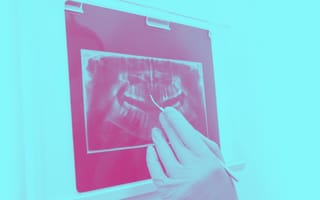 x-ray of teeth at dentist