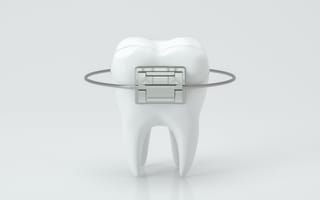 A single tooth is pictured wrapped in an orthodontic brace.
