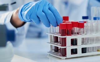 A gloved hand touches vials.