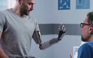 Bionic Arm