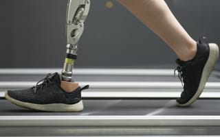 Person with prosthetic leg running on treadmill.