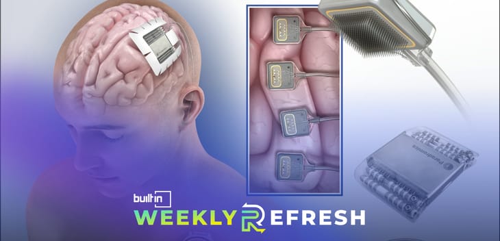An illustration of Paradromics' brain computer device.