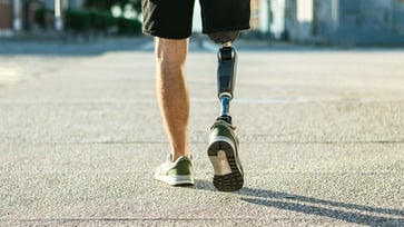 What Is a Bionic Leg?  Thumbnail