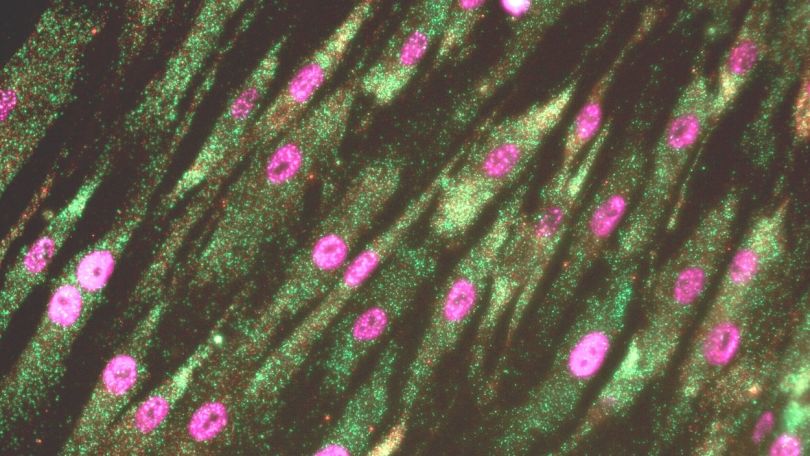 Harvard Descendant ReadCoor Raises $27 Million for Spatial Sequencing Platform