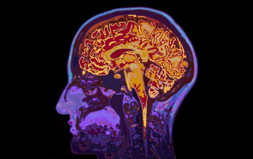 brain image mri neuralink
