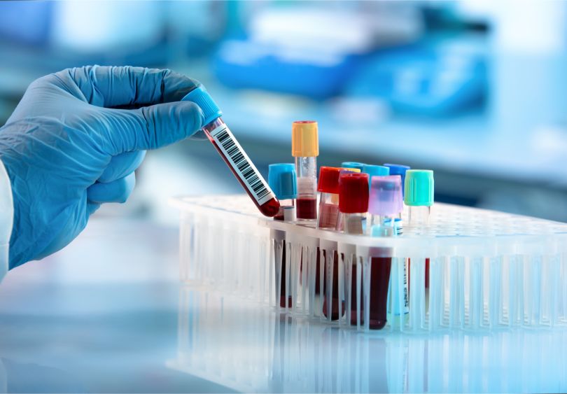 obsidian therapeutics
