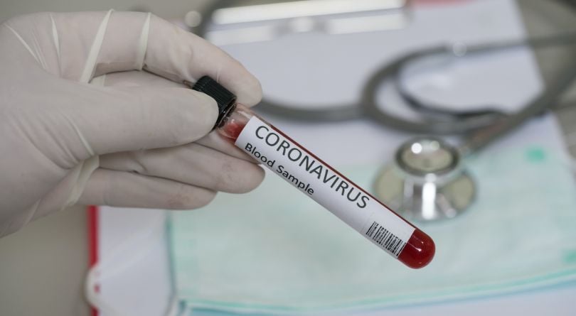 Biogen, the Broad Institute and Partners HealthCare have teamed up to build a COVID-19 biobank